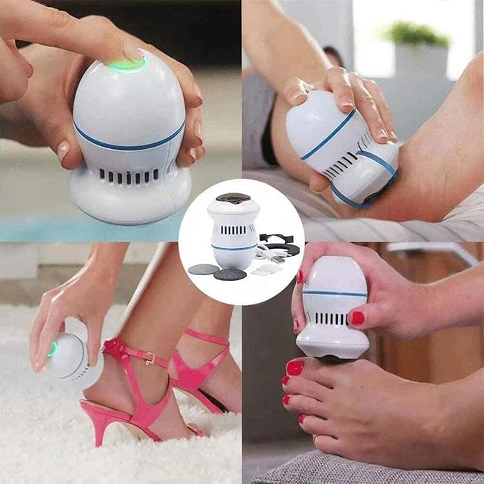 SmoothStep - Electric Callus Remover